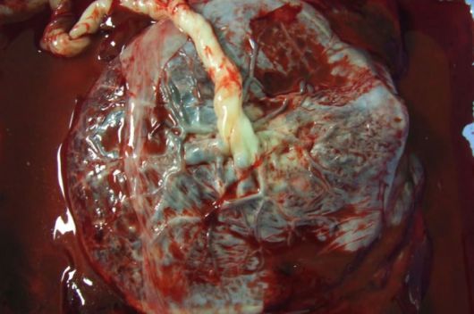 Az emberi placenta