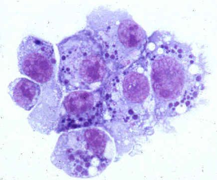 Humán anaplazmózis patogének (Anaplasmataceae család)