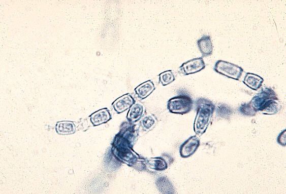 A parakoccidioidosis a paracoccidia okozója