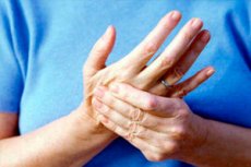 osteochondrosis jobb kéz a kéz ízületeinek deformáló artrózisa