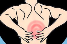 a hátfájás súlyosbodása hogyan lehet megállítani az ízületi gyulladást