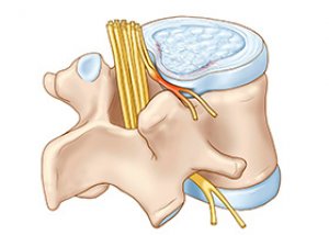 a gerinc poliszegmentális osteochondrosisa clavicularis acromialis ízületek kezelése