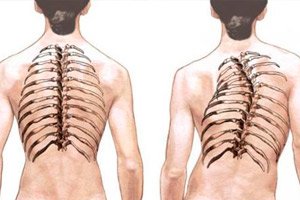 hogyan lehet kezelni a mellkasi gerinc artrózisát)