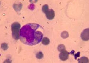 Típusú ureaplasma nőkben, mint. Ureaplasma és Mycoplasma fertőzések