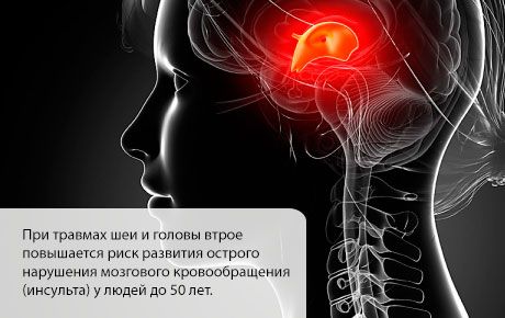 A stroke valószínűsége a fej vagy a nyak sérülését követő első hónapokban emelkedik